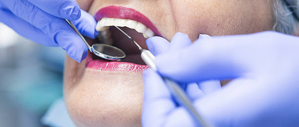 Best Broken or Cracked Tooth Emergency Dentist in Foresthill, CA